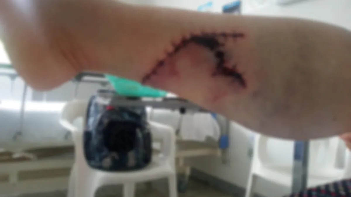Así quedó la pierna de la afectada.