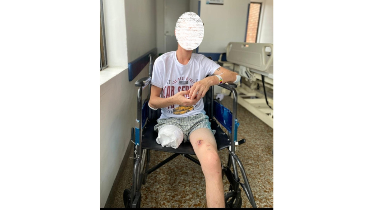 Al muchacho debieron amputarle la pierna por encima de la rodilla. Espera recuperar el movimiento de la izquierda.
