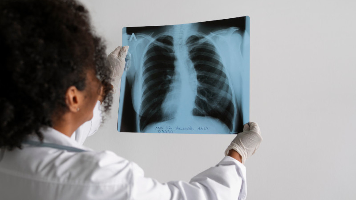 Al diagnóstico se llega tras la evaluación del paciente, la revisión de sus antecedentes, síntomas, la toma de radiografías y otras pruebas de laboratorio.