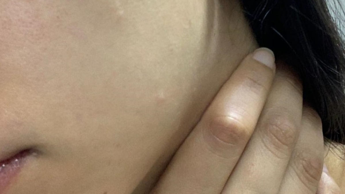 La joven agredida recibió una incapacidad de 10 días.