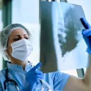 Cuídese de la tuberculosis, 76 casos en Manizales alertan a las autoridades