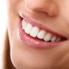 Diseño de sonrisas con carillas.  Diseño de sonrisas con carillas.