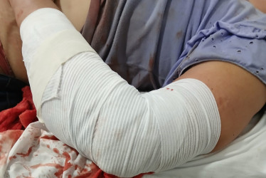 La mujer sufrió una lesión en un brazo, lo que requirió de atención de urgencias y traslado a un hospital en La Dorada.